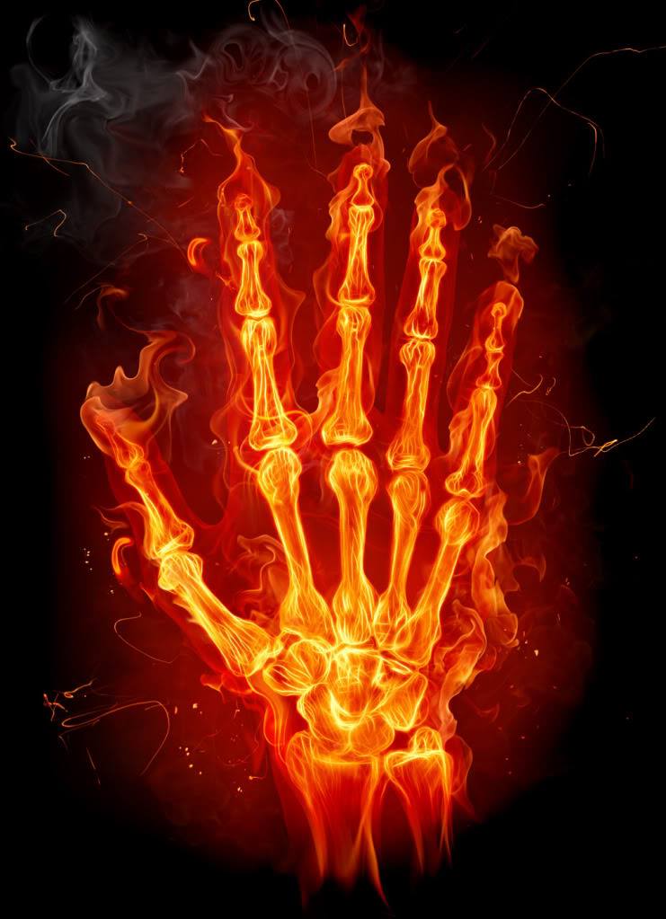 inflammation-hand